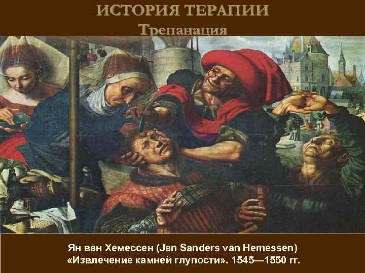 ИСТОРИЯ ТЕРАПИИ Трепанация Ян ван Хемессен (Jan Sanders van Hemessen) «Извлечение камней глупости» .