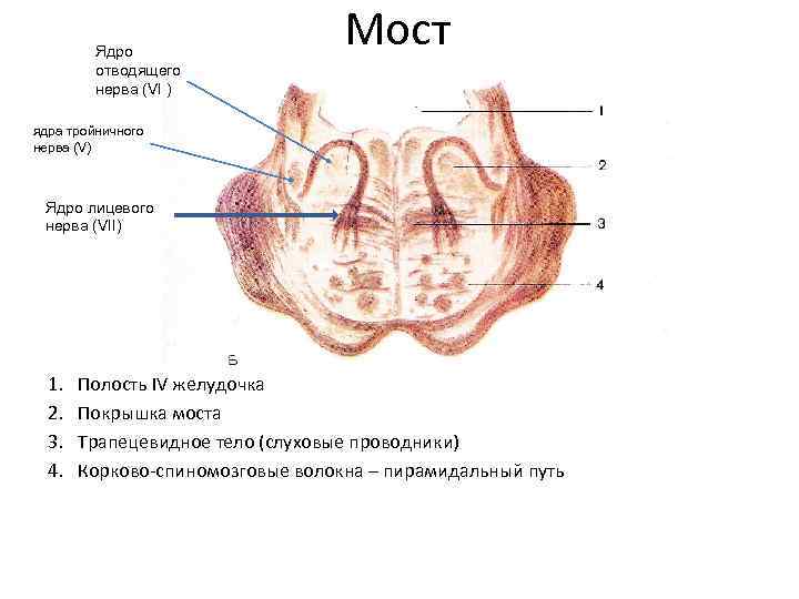 Ядро отводящего нерва (VI ) Мост ядра тройничного нерва (V) Ядро лицевого нерва (VII)
