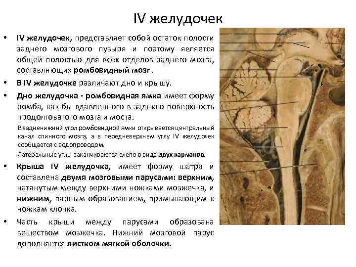 IV желудочек • • • IV желудочек, представляет собой остаток полости заднего мозгового пузыря