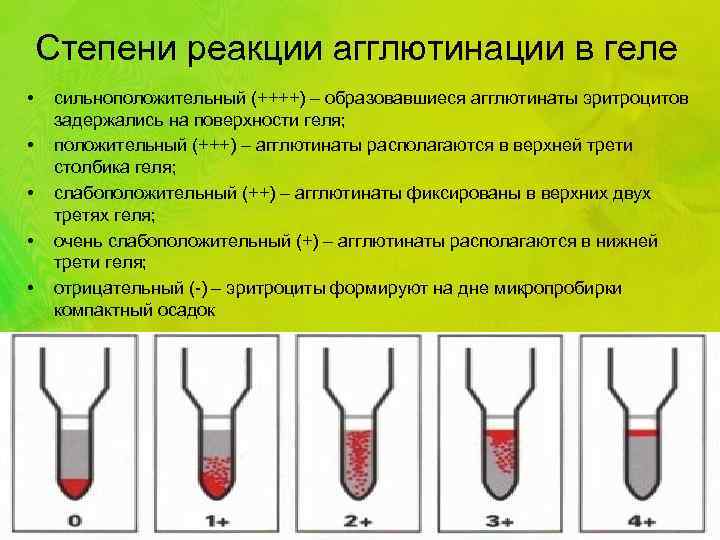 Степени реакции агглютинации в геле • • • сильноположительный (++++) – образовавшиеся агглютинаты эритроцитов
