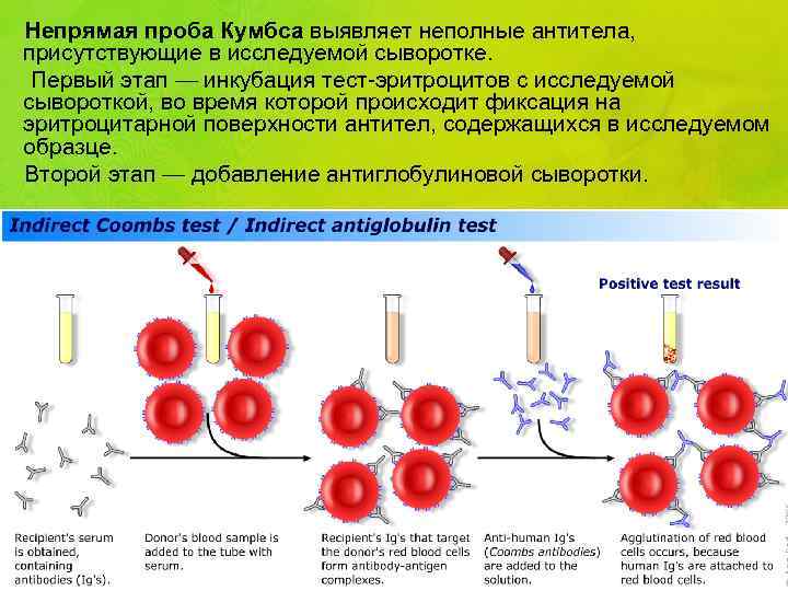 Непрямая проба Кумбса выявляет неполные антитела, присутствующие в исследуемой сыворотке. Первый этап — инкубация