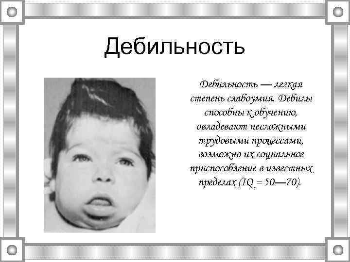 Дебильность   Дебильность — легкая  степень слабоумия. Дебилы   способны к