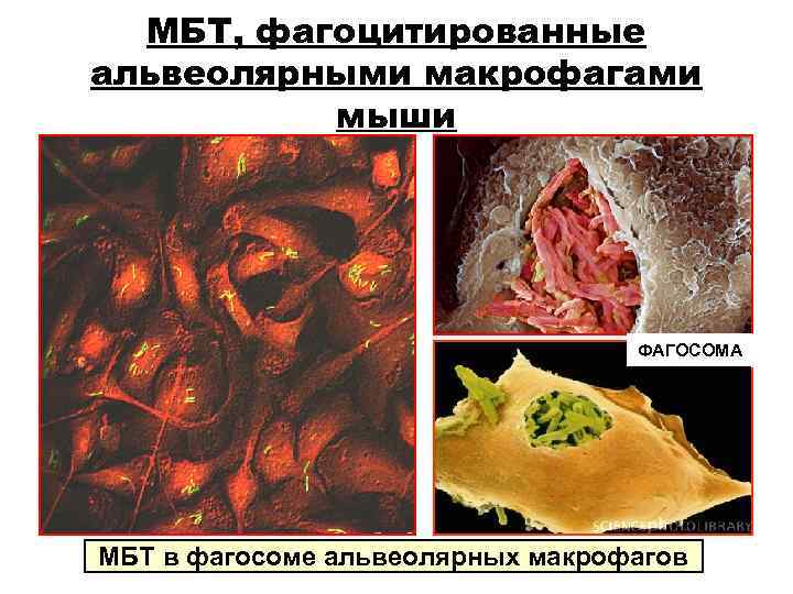 МБТ, фагоцитированные альвеолярными макрофагами мыши ФАГОСОМА МБТ в фагосоме МБТ, фагоцитированные альвеолярными макрофагами мыши ФАГОСОМА МБТ в фагосоме