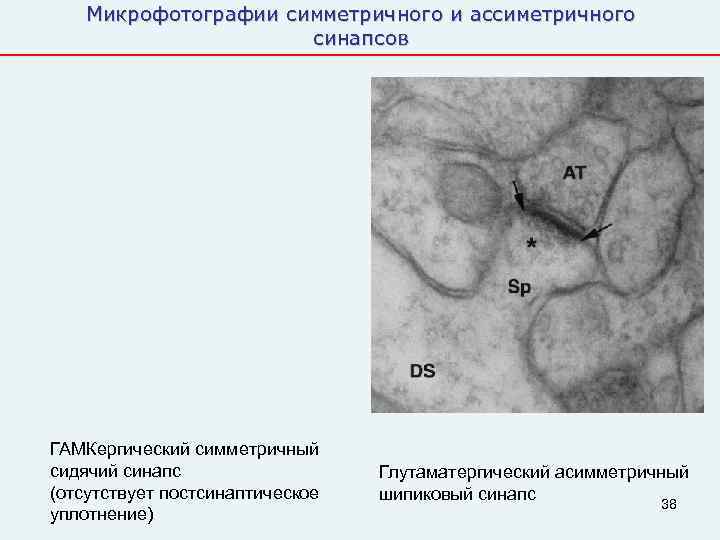   Микрофотографии симметричного и ассиметричного    синапсов ГАМКергический симметричный сидячий синапс