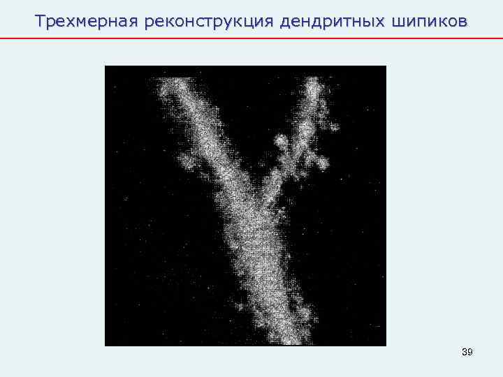 Трехмерная реконструкция дендритных шипиков    39 