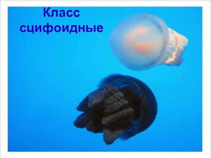   Класс сцифоидные 