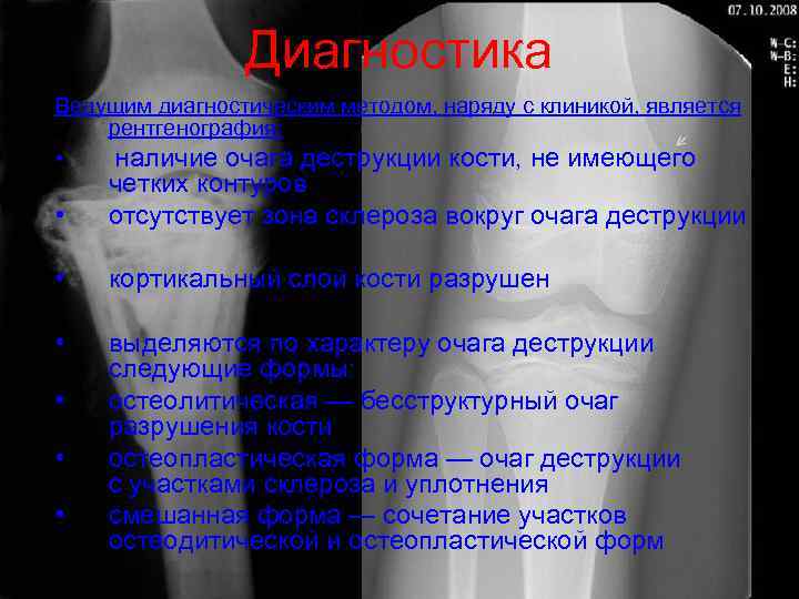     Диагностика Ведущим диагностическим методом, наряду с клиникой, является рентгенография: 