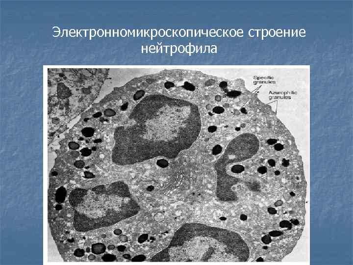 Электронномикроскопическое строение нейтрофила 
