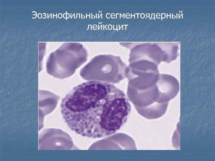 Эозинофильный сегментоядерный лейкоцит 