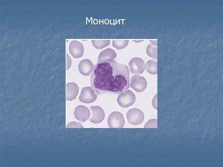 Моноцит 