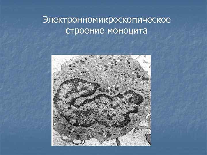 Электронномикроскопическое строение моноцита 