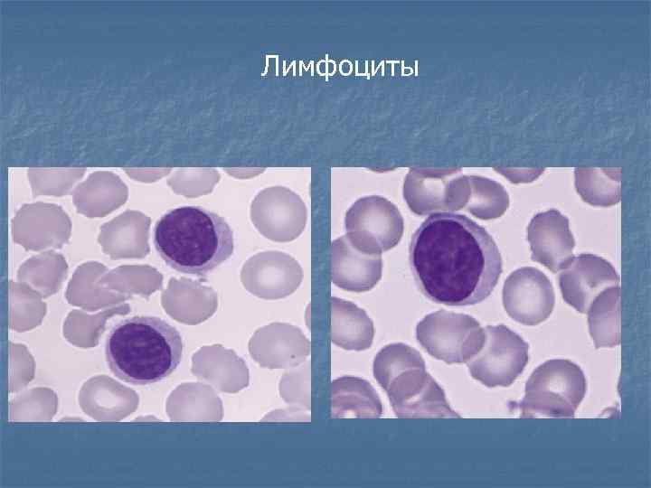 Лимфоциты 