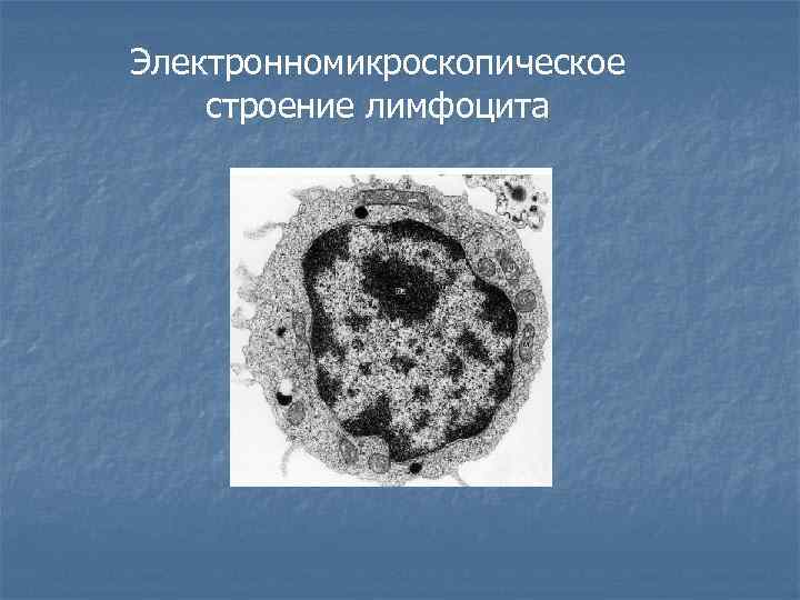 Электронномикроскопическое строение лимфоцита 