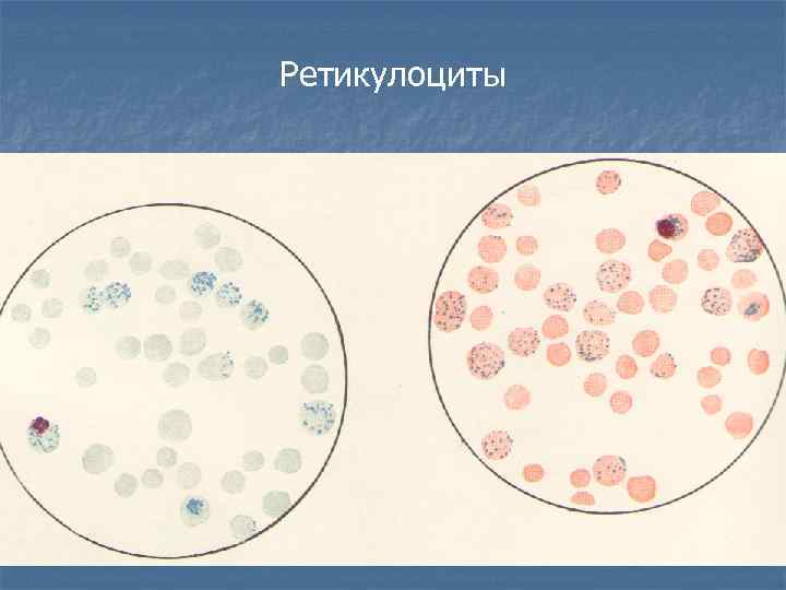 Ретикулоциты фото под микроскопом