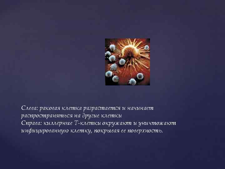 Слева: раковая клетка разрастается и начинает распространяться на другие клетки Справа: киллерные Т-клетки окружают