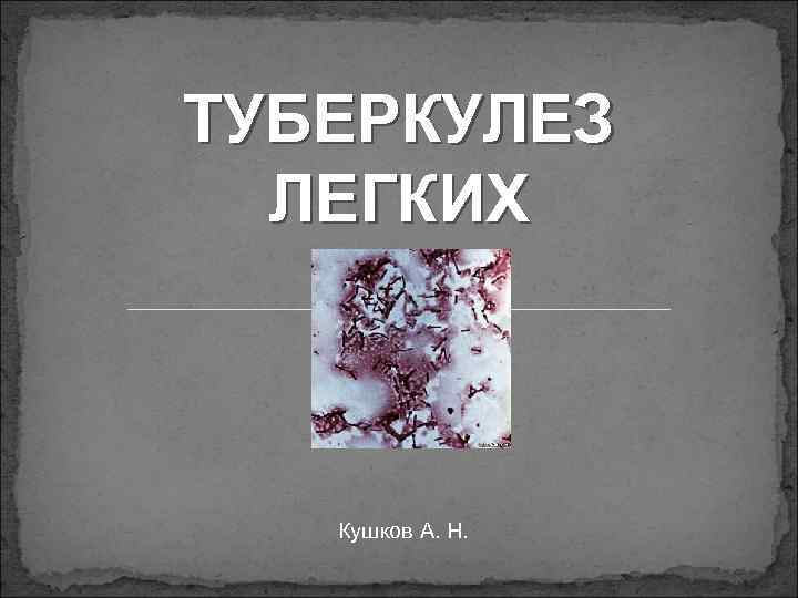 ТУБЕРКУЛЕЗ  ЛЕГКИХ  Кушков А. Н. 