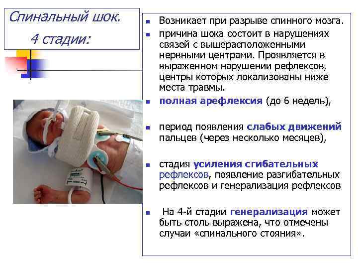 Спинальный шок. 4 стадии: n n n Возникает при разрыве спинного мозга. причина шока