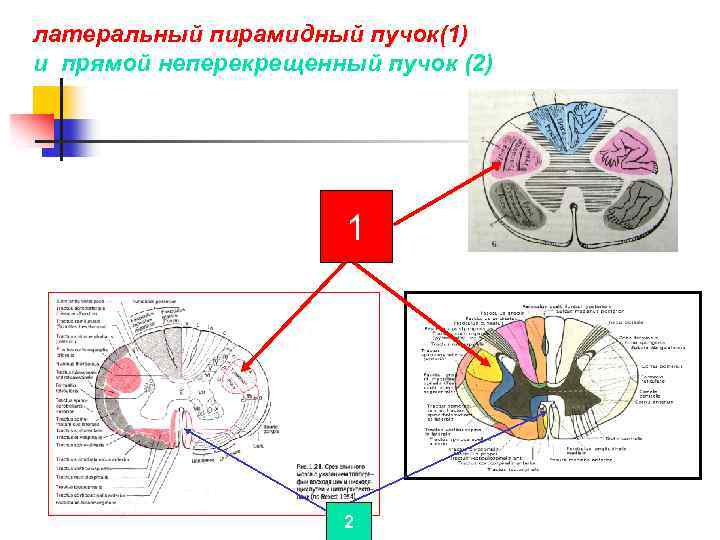 Поражение двигательного анализатора на различных уровнях поражения схема