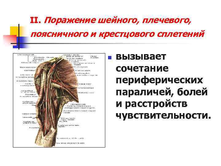 II. Поражение шейного, плечевого, поясничного и крестцового сплетений n вызывает сочетание периферических параличей, болей