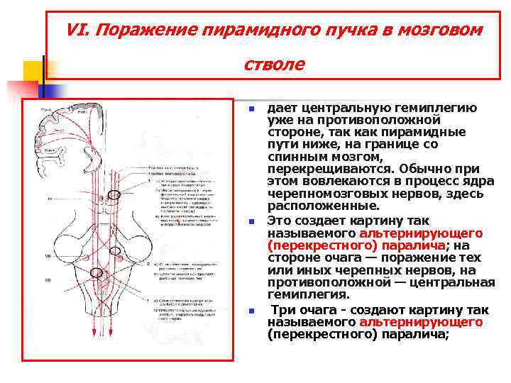 Поражение двигательного анализатора на различных уровнях поражения схема