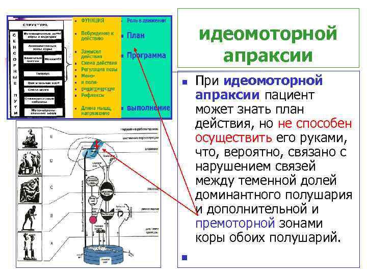 идеомоторной апраксии n n При идеомоторной апраксии пациент может знать план действия, но не