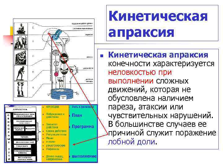 Кинетическая апраксия n Кинетическая апраксия конечности характеризуется неловкостью при выполнении сложных движений, которая не