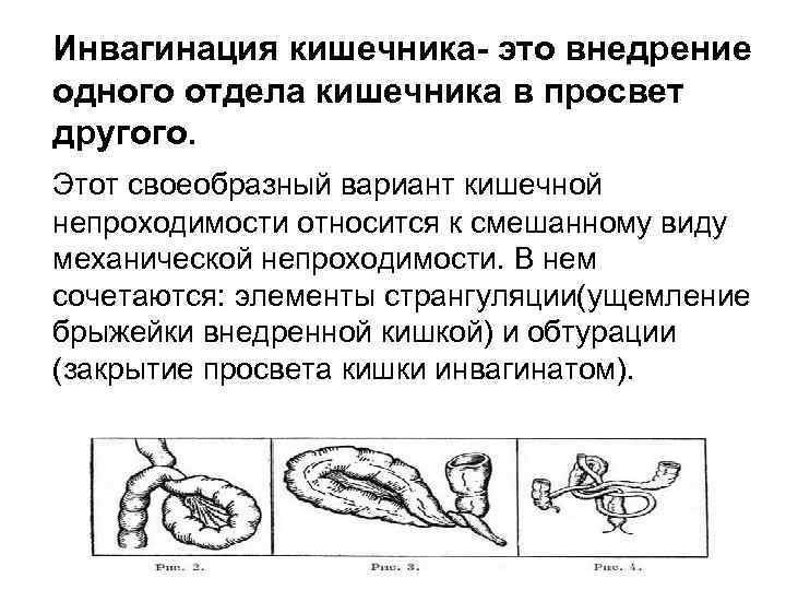 Кишечник картинка для детей