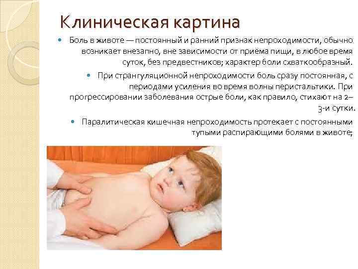 Клиническая картина Боль в животе — постоянный и ранний признак непроходимости, обычно  