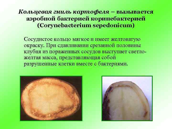 Кольцевая гниль картофеля – вызывается  аэробной бактерией коринебактерией (Corynebacterium sepedonicum)  Сосудистое кольцо