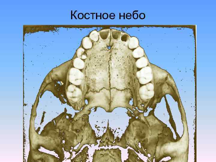 Костное небо 