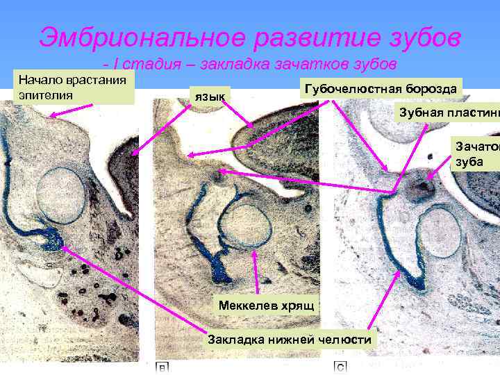 Рентгенологическая картина зубов и их зачатков на различных этапах формирования