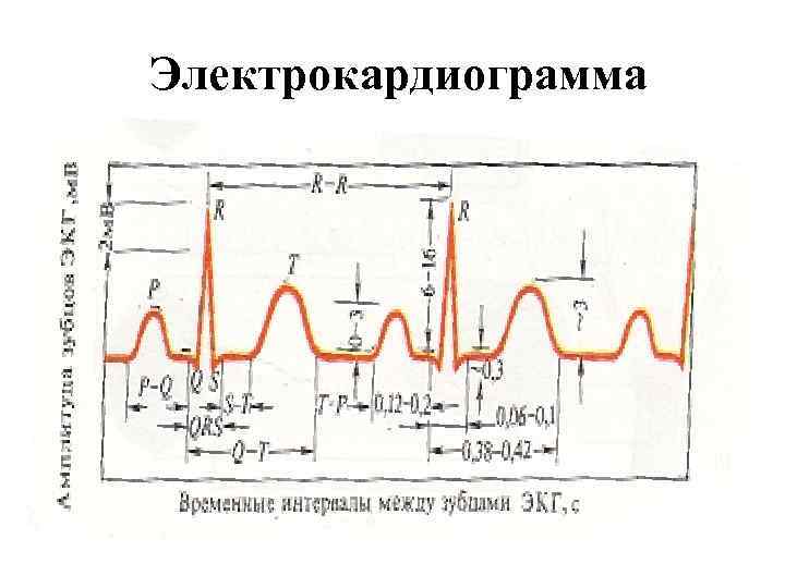 Электрокардиограмма 