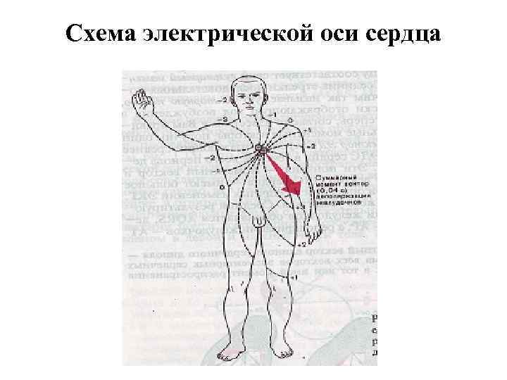 Схема электрической оси сердца 