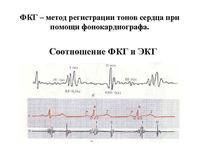 ФКГ – метод регистрации тонов сердца при  помощи фонокардиографа.  Соотношение ФКГ и