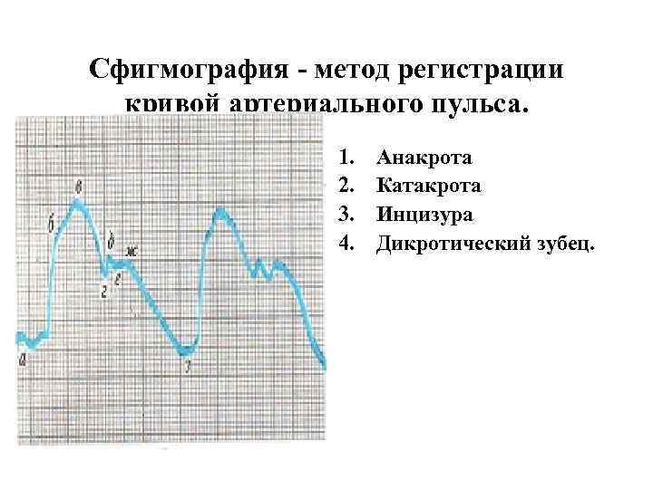 Сфигмография - метод регистрации  кривой артериального пульса.   1.  Анакрота 
