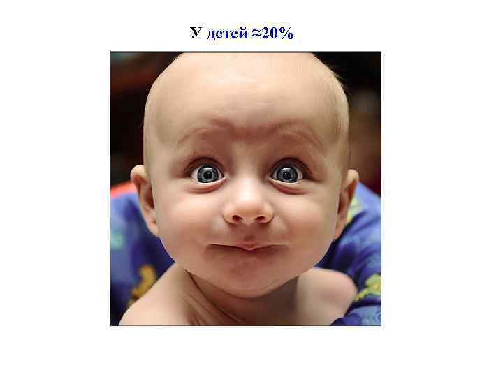 У детей ≈20% 