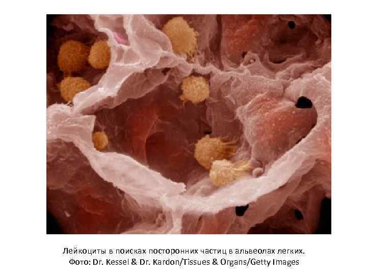 Лейкоциты в поисках посторонних частиц в альвеолах легких.  Фото: Dr. Kessel & Dr.