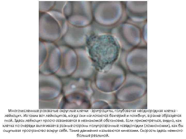   Многочисленные розоватые округлые клетки  эритроциты, голубоватая неоднородная клетка лейкоцит. Из таких
