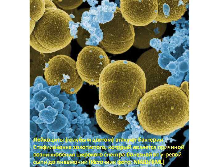 Лейкоциты (голубым цветом) атакуют бактерии Стафилококка золотистого, который является причиной возникновения широкого спектра болезней