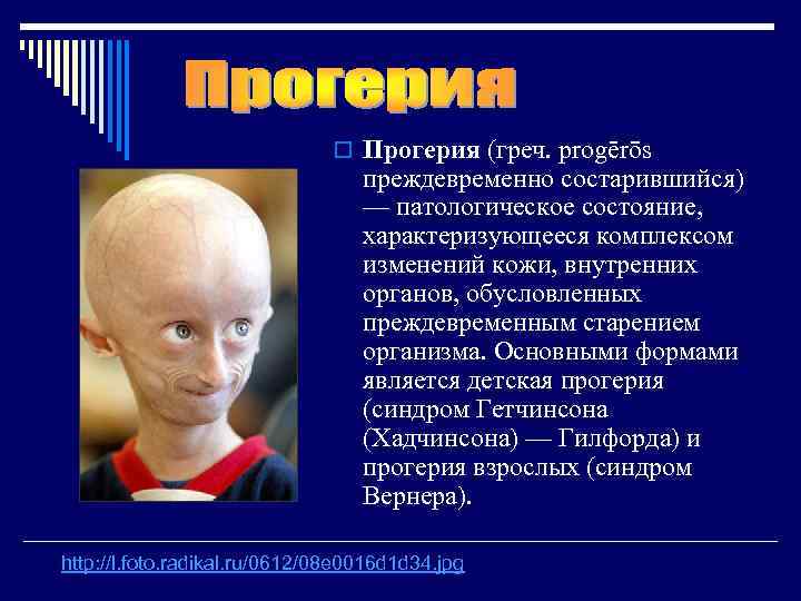      o Прогерия (греч. progērōs     