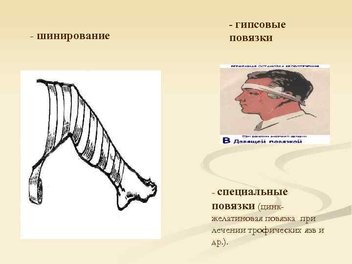     - гипсовые - шинирование повязки     -