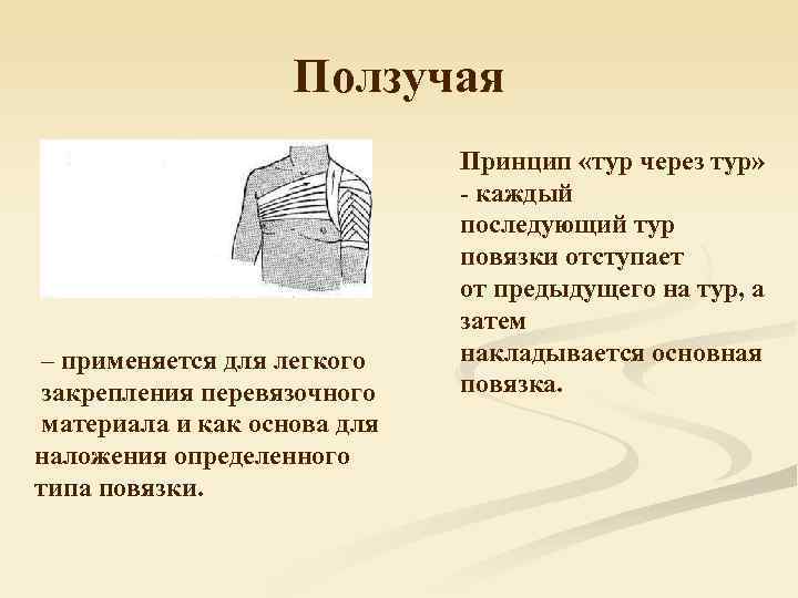 Каждый последующий. Ползучая повязка. Ползучая повязка накладывается. Десмургия ползучая повязка. Ползучая повязка алгоритм.