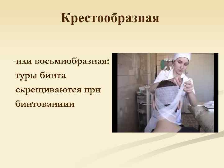    Крестообразная  -или восьмиобразная:  туры бинта скрещиваются при бинтованиии 