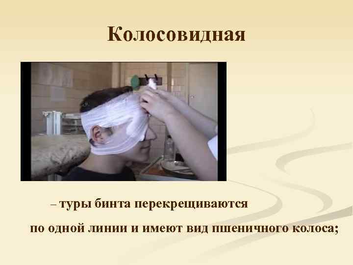   Колосовидная  – туры бинта перекрещиваются по одной линии и имеют вид