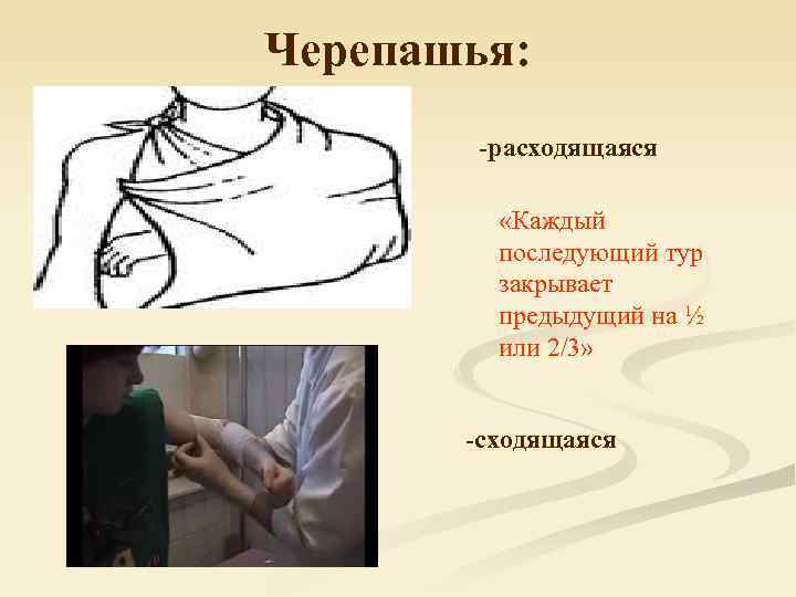    Черепашья:     -расходящаяся     «Каждый