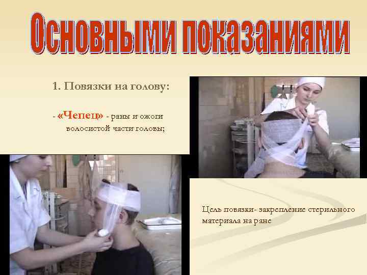 1. Повязки на голову:  - «Чепец» - раны и ожоги  волосистой части