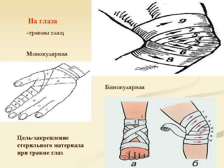   На глаза  -травмы глаз; Монокулярная     Бинокулярная Цель-закрепление