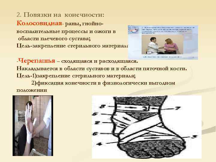 2. Повязки на конечности: Колосовидная- раны, гнойно- воспалительные процессы и ожоги в области плечевого