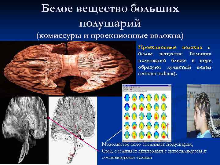 Белое вещество больших полушарий (комиссуры и проекционные волокна) Белое вещество больших полушарий (комиссуры и проекционные волокна)