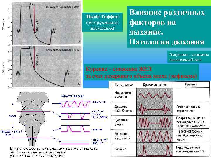 Проба Тиффно   Влияние различных (обструктивные  факторов на  нарушения)  
